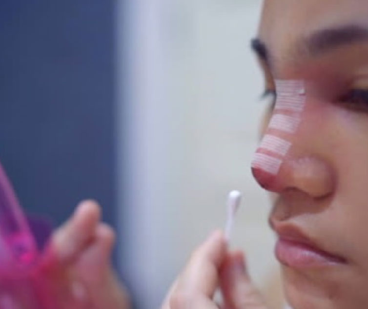التمخط بعد عملية تجميل الأنف 8 التمخط بعد عملية تجميل الأنف