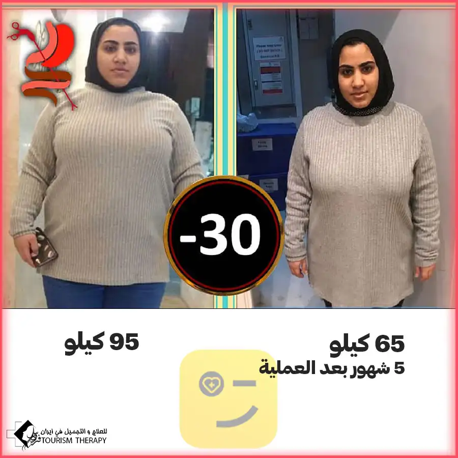 سعر عملية قص المعدة في مشهد مع الدكتور احمد نجاد رحيم
