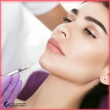 فيلر الذقن