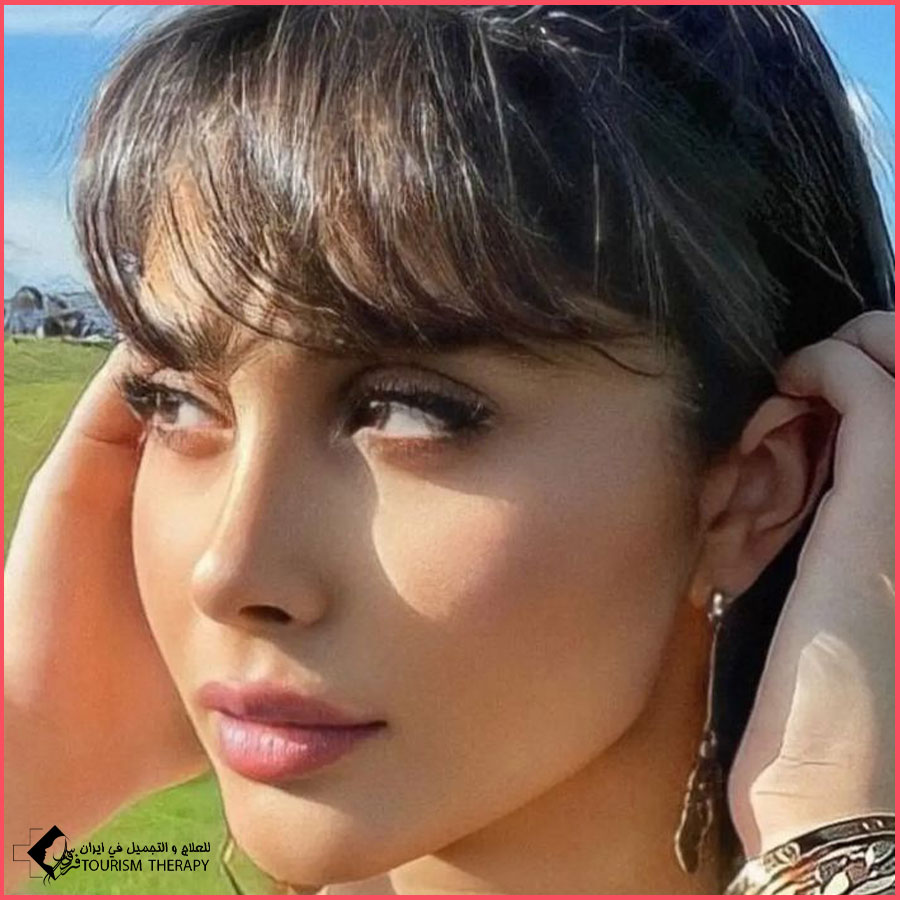 تجميل الأنف | الدكتور شهريار لقماني