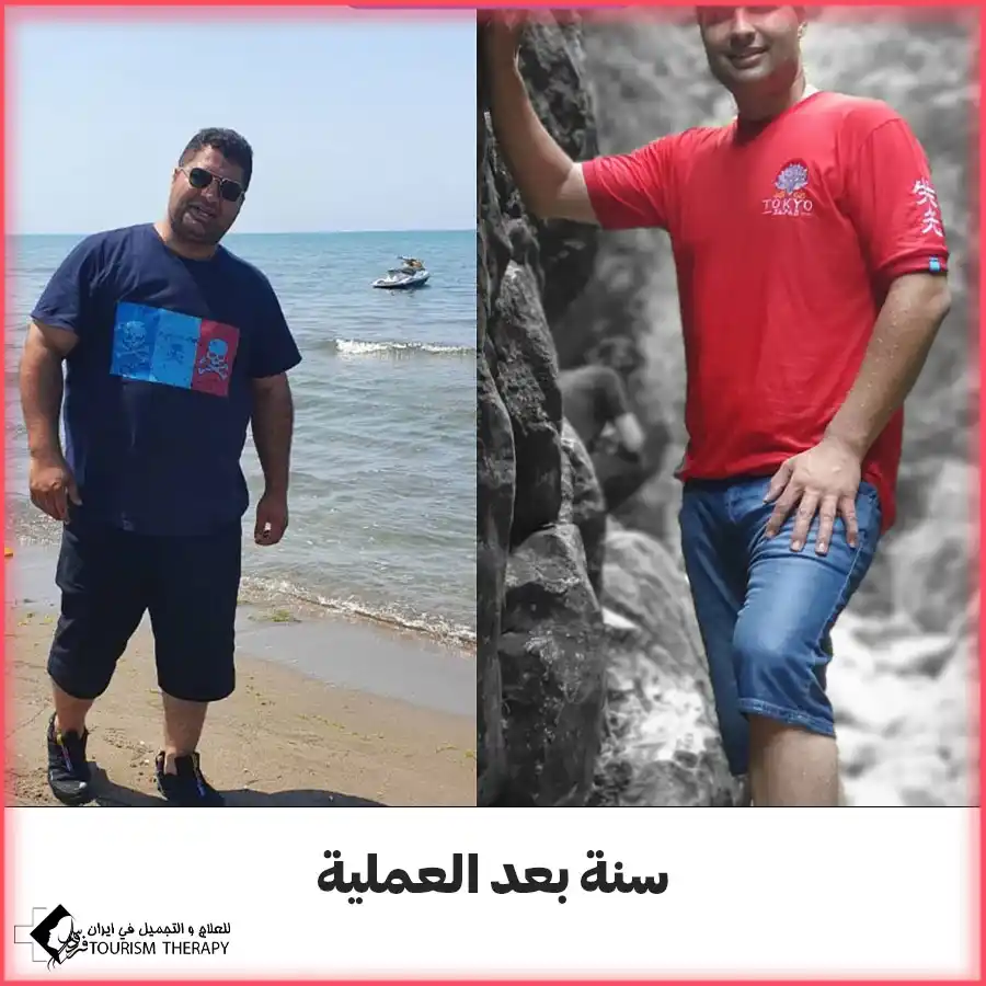 dr mohammad rajaei minibypass عملية تحويل مسار المعدة في مشهد | الدكتور سيد فاضل اعلمي