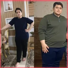 عملية تحويل مسار المعدة في مشهد مع الدكتور سيد فاضل اعلمي