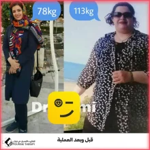 تحويل مسار المعدة في مشهد مع الدكتور سيد فاضل اعلمي