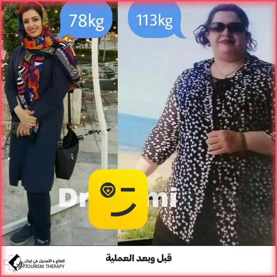 تحويل مسار المعدة في مشهد مع الدكتور سيد فاضل اعلمي