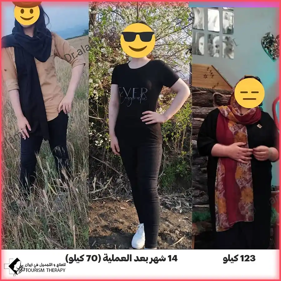 عملية تحويل مسار المعدة مع الدكتور سيد فاضل اعلمي في مشهد
