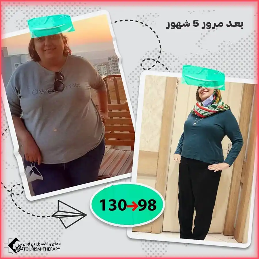 تكلفة عملية تحويل مسار المعدة في مشهد مع الدكتور احمد نجاد رحيم