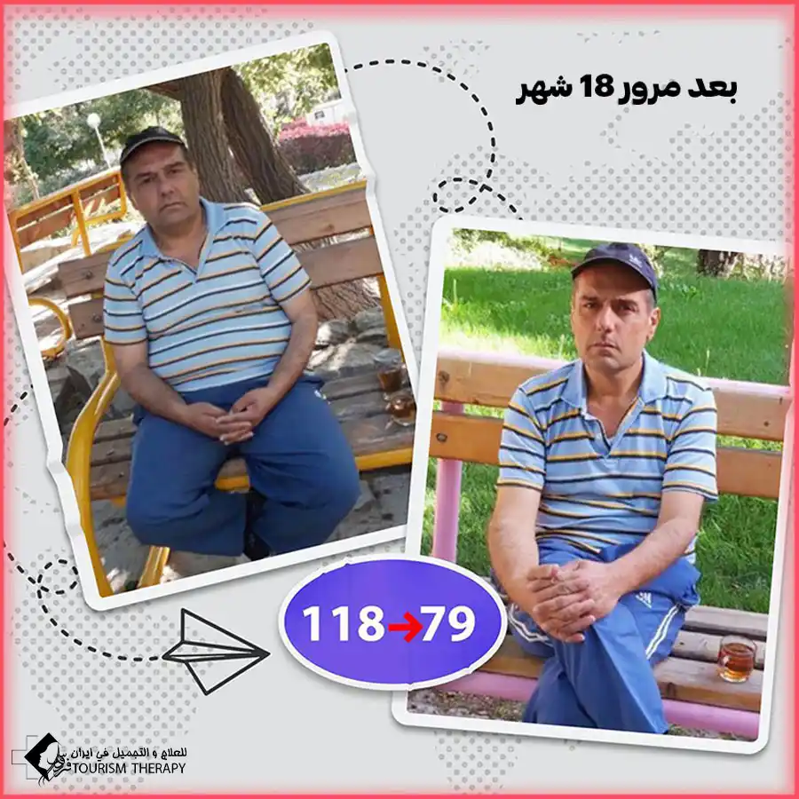 سعر عملية تحويل مسار المعدة في مشهد مع الدكتور احمد نجاد رحيم