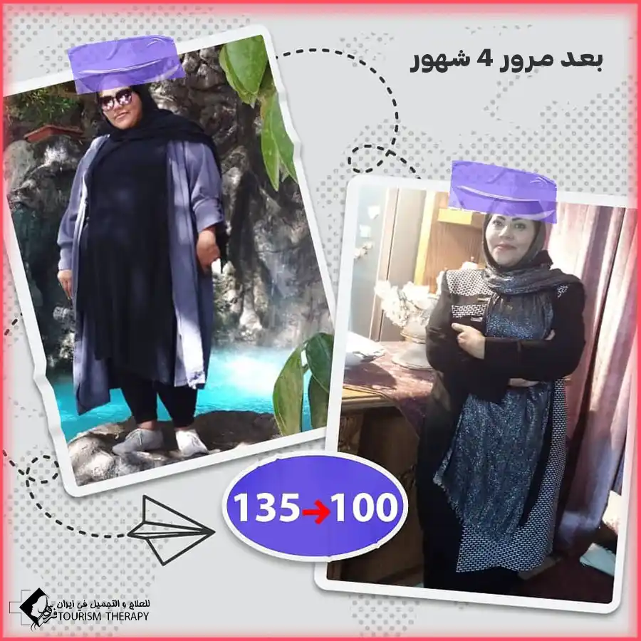 حجز موعد عملية تحويل مسار المعدة في مشهد مع الدكتور احمد نجاد رحيم