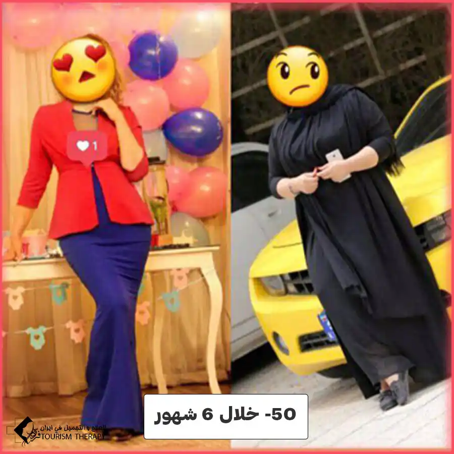 عملية تحويل مسار المعدة في مشهد مع الدكتور سجاد نور شفيعي