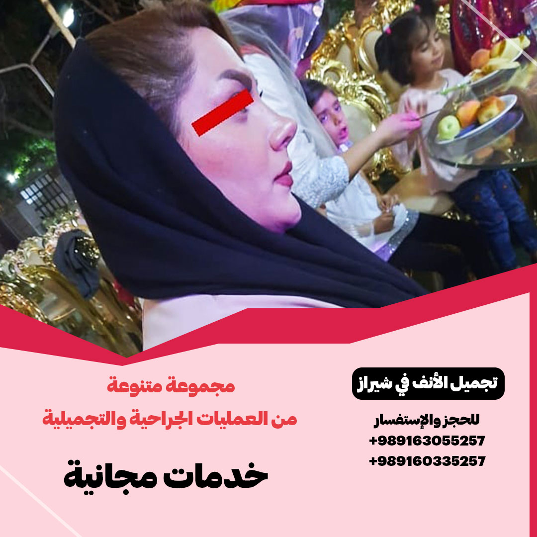 Dr Zohreh Zandifar in Shiraz تجميل الأنف | الدكتورة زهرة زندي فر