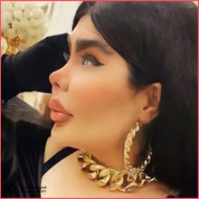 تجميل الأنف في طهران مع الدكتور ابو الفضل صالح راد