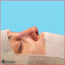 الدكتورة آزاده ناصحي – جراحة تجميل الأنف في طهران بدقة متناهية ورؤية فنية