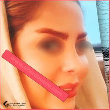 الدكتورة فاطمة آقايي – جراحة تجميل الأنف في طهران بـ24 عاماً من الخبرة والإبداع