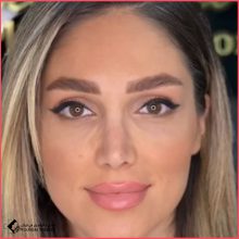 تجميل الأنف في طهران الدكتور حسام شبيري