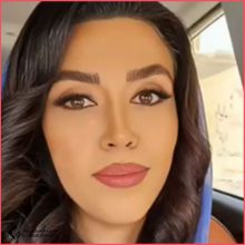 تجميل الأنف في ايران مع الدكتور حسين طاهريان