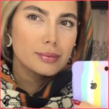 تجميل الأنف في طهران مع الدكتور كامران اكرمي