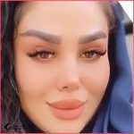 تجميل الأنف في مشهد مع الدكتور كيامرز ميلاني