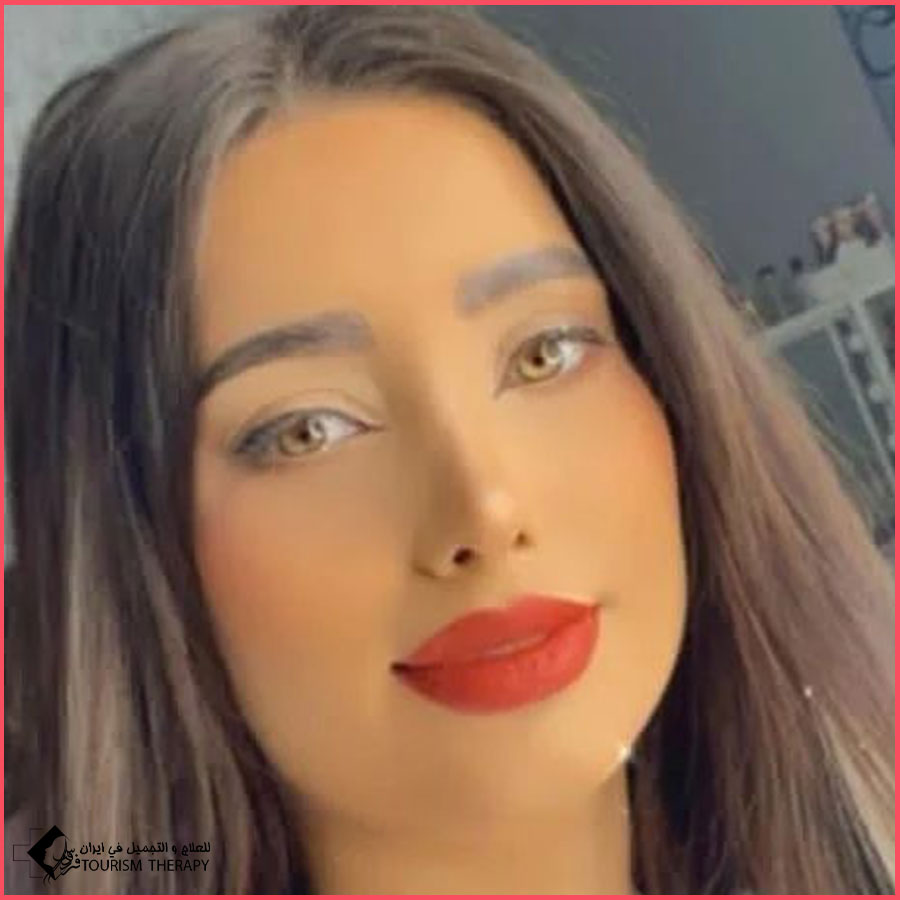 تجميل الأنف في طهران الدكتورة سيدة نفيسة خليلي