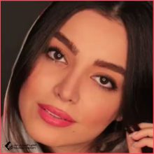 الدكتورة روزينا بشارتي زاده – جراحة تجميل الأنف في طهران الحاصلة على المرتبة الثالثة في البورد