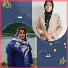 عملية ثنائي تقسيم المعدة في مشهد مع الدكتور سيد فاضل اعلمي