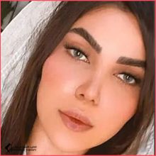 تجميل الأنف مع الدكتور شهريار يحيوي في طهران
