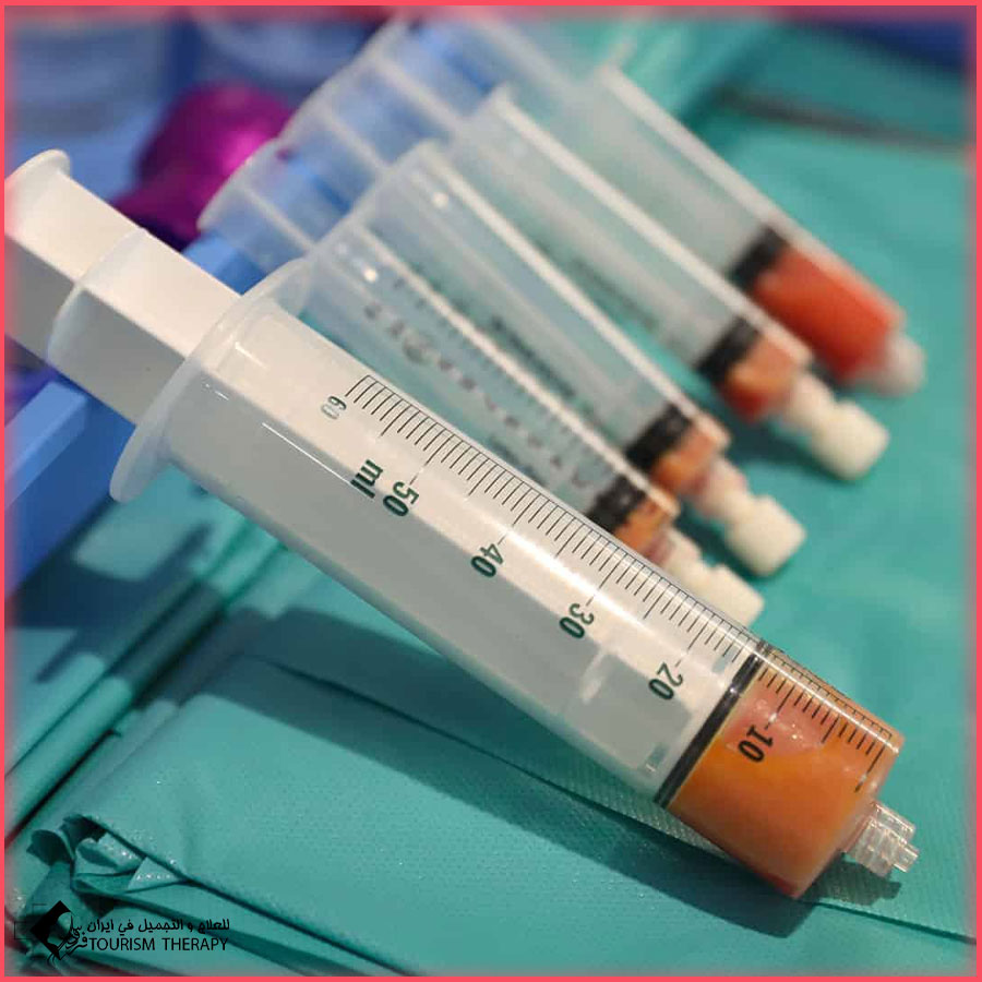 Penoplasty with stem cell in Iran تكبير القضيب بالخلايا الجذعية