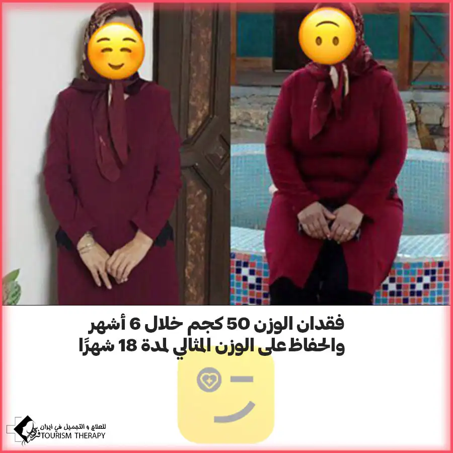 افضل دكتور عملية قص المعدة في مشهد الدكتور سجاد نور شفيعي