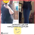 عملية قص المعدة في مشهد مع الدكتور سجاد نور شفيعي