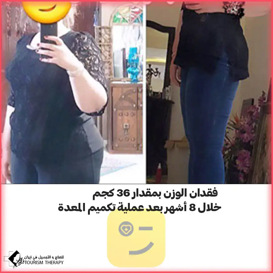 عملية قص المعدة في مشهد مع الدكتور سجاد نور شفيعي