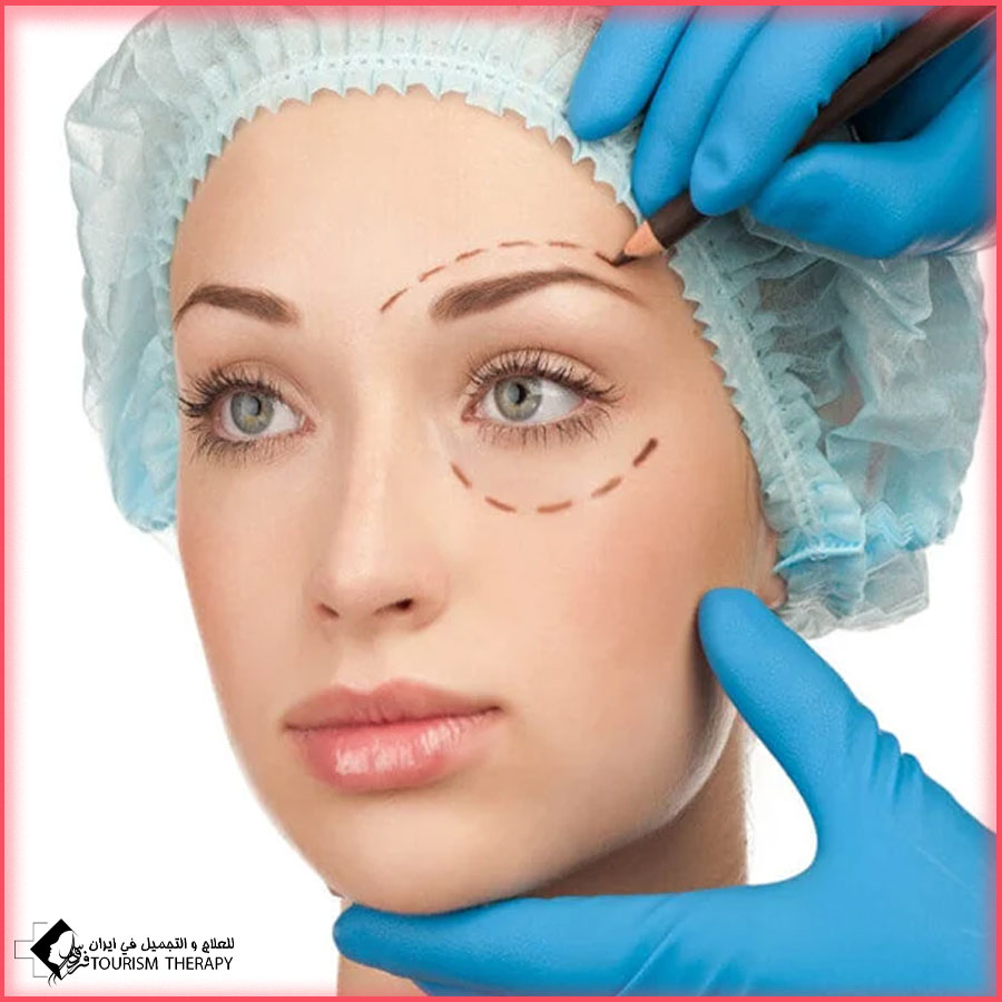 جراحة تجميل الجفون العلوية والسفلية في طهران مع الدكتور هادي آمالي