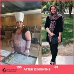 عملية تحويل مسار المعدة في شيراز | الدكتور سيد ناصر افشين