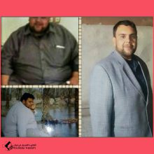 تحويل مسار المعدة في شيراز | الدكتور ابراهيم خردمند