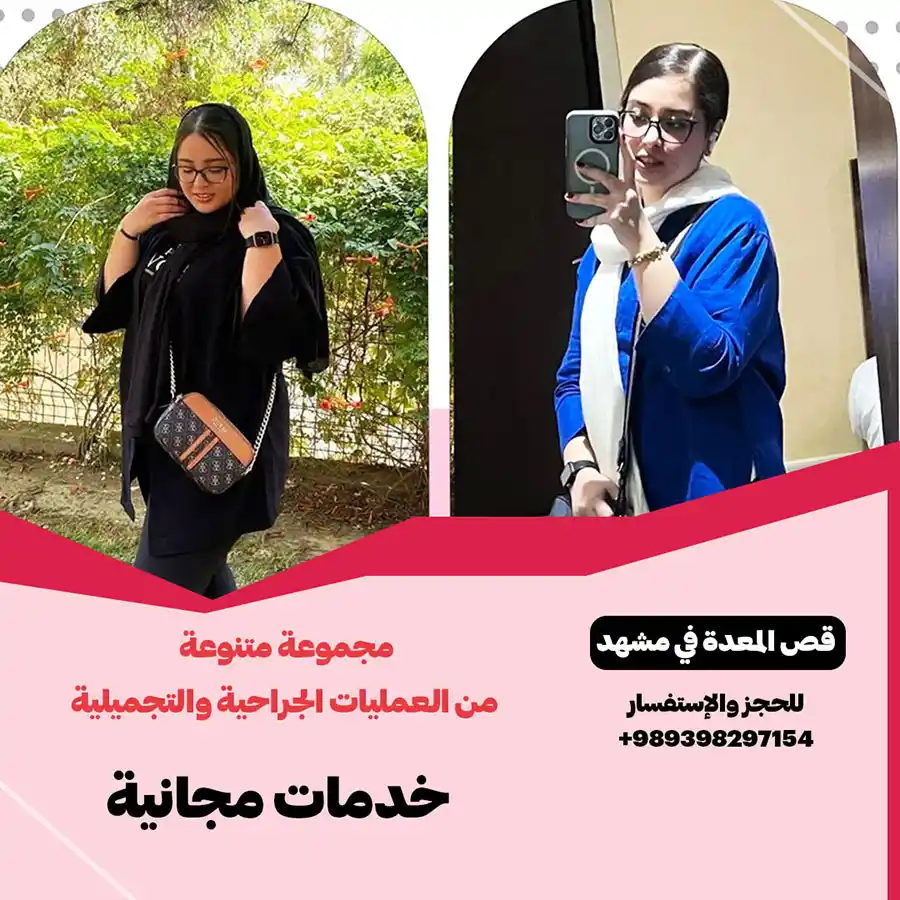 dr mohammad rajaei minibypass تكلفة عملية تحويل مسار المعدة في مشهد مع الدكتور حامد گل محمد زادة