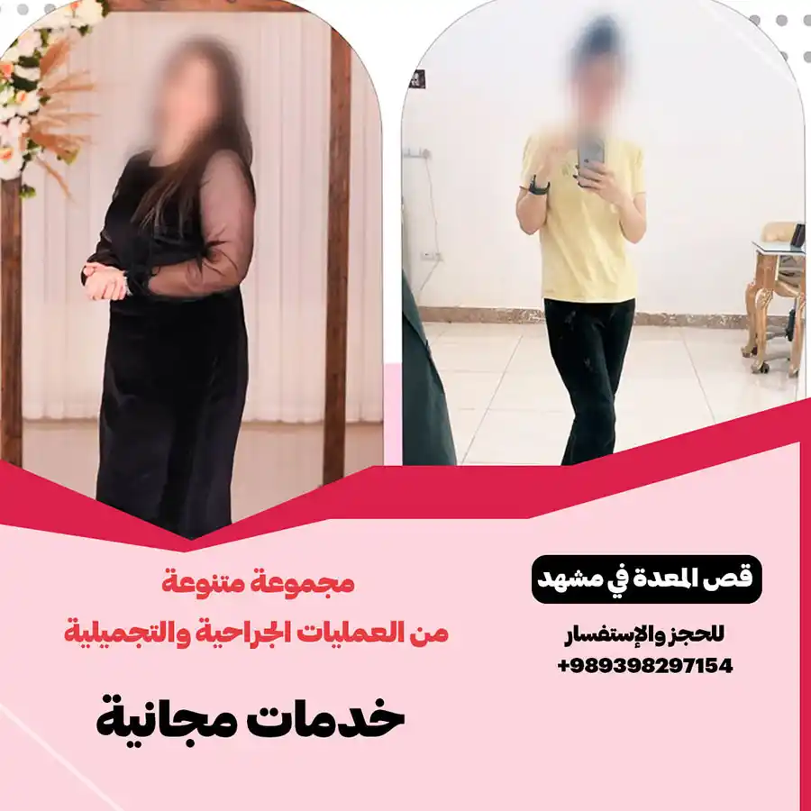 عملية تحويل مسار المعدة في مشهد مع الدكتور حامد گل محمد زادة