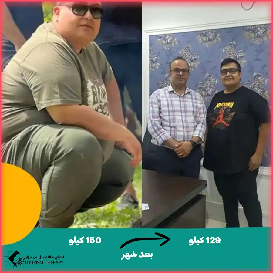 عملية تحويل مسار المعدة في مشهد مع الدكتور محمد ابراهيم كلانتري