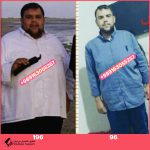 تحويل مسار المعدة في شيراز | الدكتور ابراهيم خردمند