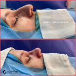 تجميل الأنف في مشهد مع الدكتور عزت الله رضائي