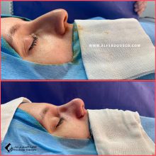 تجميل الأنف في مشهد مع الدكتور عزت الله رضائي