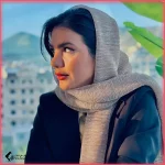 تجميل الأنف في مشهد مع الدكتورة وحيدة موسوي