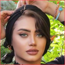 تجميل الأنف | الدكتور حسين كرم نجاد