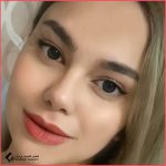 تجميل الأنف | الدكتور وحيد دستگردي