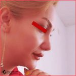 تجميل الأنف | الدكتورة زهرة زندي فر