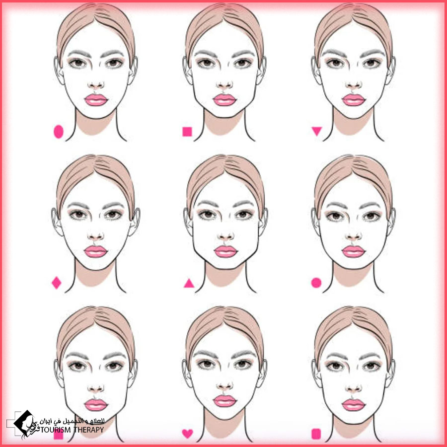 jaw angle implant dr amali Hadi عملية سليكون تحديد الفك في طهران