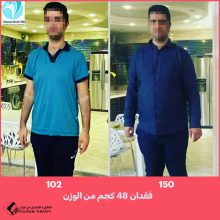 تحويل مسار المعدة المصغر في شيراز | الدكتور مسعود اميني