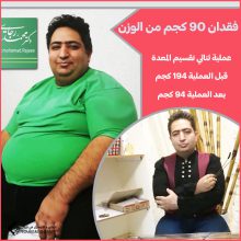 ثنائي تقسيم المعدة في شيراز | الدكتور محمد رجايي