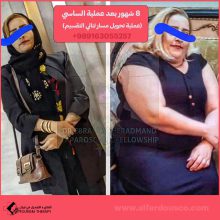 ثنائي تقسيم المعدة في شيراز | الدكتور ابراهيم خردمند