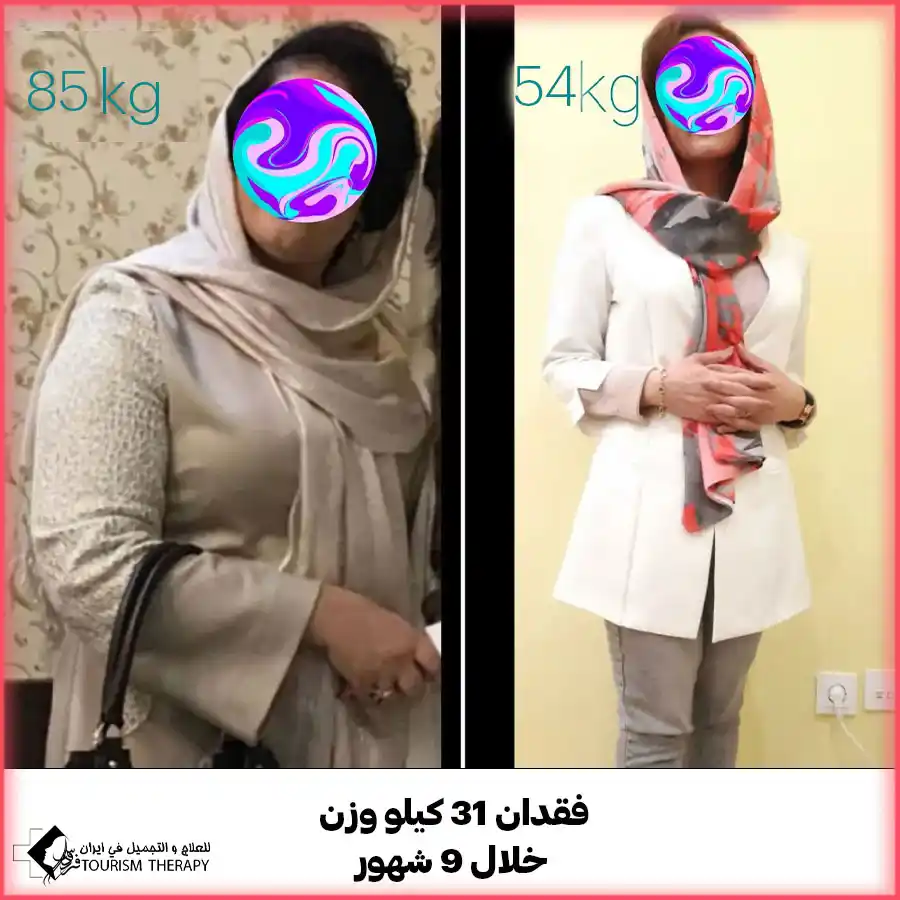 عملية ثنائي تقسيم المعدة في مشهد مع الدكتور محمد ابراهيم كلانتري