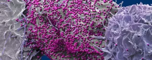 غسل السائل المنوي للمصابين بـ HIV-1