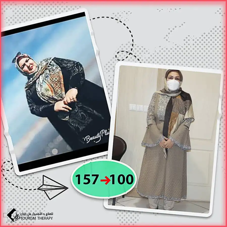 عملية قص المعدة في مشهد مع الدكتور احمد نجاد رحيم