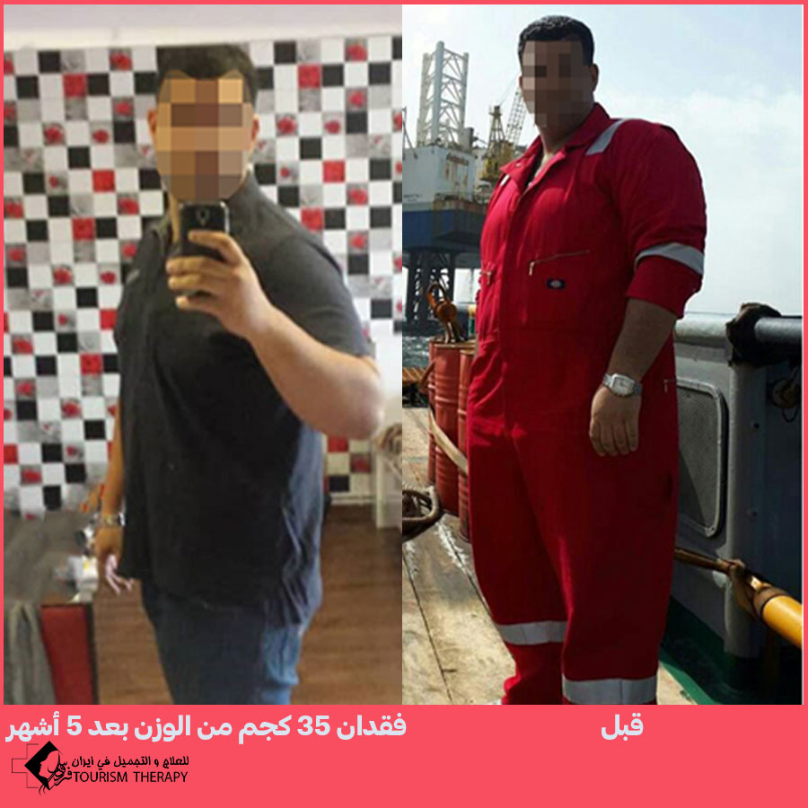 قص المعدة في شيراز | الدكتور مهدي تهمتن